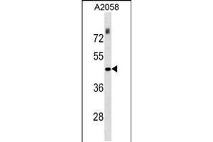 Western blot analysis in A2058 cell line lysates (35ug/lane). (THO Complex 3 抗体  (N-Term))