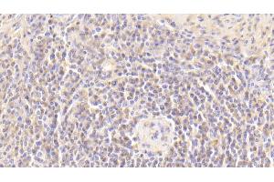 Immunohistochemistry (IHC) image for anti-V-Set Domain Containing T Cell Activation Inhibitor 1 (VTCN1) (AA 34-147) antibody (ABIN7436759)