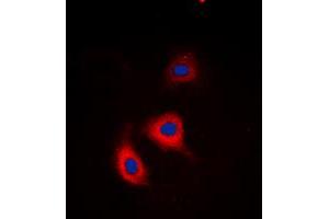 Immunofluorescent analysis of Alpha-adducin (pS726/713) staining in HeLa cells. (alpha Adducin 抗体  (C-Term, pSer713, pSer726))