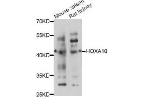 Western blot analysis of extracts of various cell lines, using HOXA10 antibody. (HOXA10 抗体)