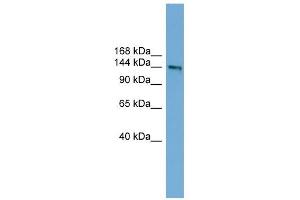 DCC antibody used at 1 ug/ml to detect target protein. (DCC 抗体  (Middle Region))