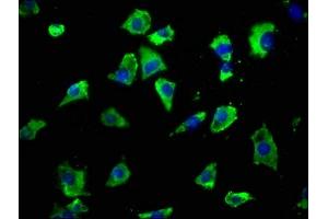 Immunofluorescence staining of SH-SY5Y cells with ABIN7153973 at 1:50, counter-stained with DAPI. (GRIK2 抗体  (AA 203-500))
