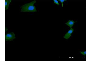 Immunofluorescence of purified MaxPab antibody to SKIV2L on HeLa cell. (SKIV2L 抗体  (AA 1-1246))