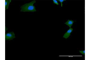Immunofluorescence of purified MaxPab antibody to SKIV2L on HeLa cell.