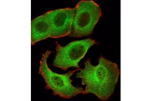 Fluorescent ige of MCF-7 cells stained with SD1 Antibody (Center) (ABIN6242631 and ABIN6577423). (SMAD1 抗体  (AA 163-196))