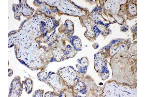 IHC analysis of CD151 using anti- CD151 antibody .
