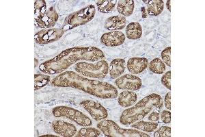 Immunohistochemistry of paraffin-embedded mouse kidney using FBP1 Rabbit mAb (ABIN7267269) at dilution of 1:100 (40x lens).