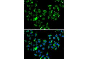 Immunofluorescence analysis of  cells using C antibody (ABIN6127550, ABIN6137939, ABIN6137940 and ABIN6222956). (CARD11 抗体  (AA 985-1154))