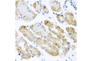 Immunohistochemistry of paraffin-embedded human gastric using RPS2 antibody at dilution of 1:100 (x40 lens). (RPS2 抗体)