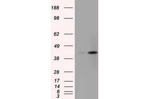 Image no. 6 for anti-Acetyl-CoA Acetyltransferase 2 (ACAT2) antibody (ABIN1496403) (ACAT2 抗体)