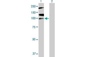 Western Blot analysis of RNF111 expression in transfected 293T cell line by RNF111 MaxPab polyclonal antibody. (RNF111 抗体  (AA 1-985))