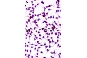Immunocytochemistry (ICC) staining of HEK293 human embryonic kidney cells transfected (A) or untransfected (B) with GPRC5A. (GPRC5A 抗体  (Extracellular Domain))