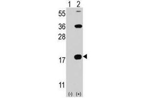 Image no. 1 for anti-CD247 Molecule (CD247) (C-Term) antibody (ABIN356886) (CD247 抗体  (C-Term))