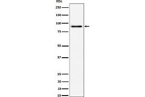 Western blot analysis of ACAP2 expression in 293 cell lysate. (Recombinant Centaurin beta 2 抗体)