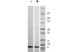 SDS-PAGE of Human Insulin-like Growth Factor I Recombinant Protein SDS-PAGE of Human Insulin-like Growth Factor I Recombinant Protein. (IGF1 蛋白)