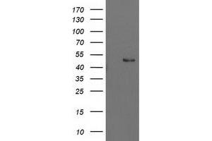 Western Blotting (WB) image for anti-Pre-B-Cell Leukemia Homeobox Protein 1 (PBX1) antibody (ABIN1500044) (PBX1 抗体)
