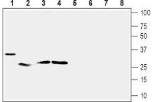 Western blot analysis of mouse heart (lanes 1 and 5), rat skeletal muscle (lanes 2 and 6), rat adipose tissue (lanes 3 and 7) and rat pancreas (lanes 4 and 8):1-4. (Uncoupling Protein 2 (Mitochondrial, Proton Carrier) (UCP2) Peptide)