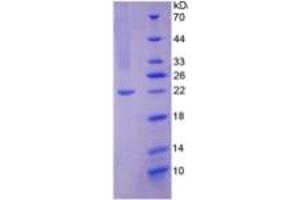 SDS-PAGE of Protein Standard from the Kit  (Highly purified E. (NOS2 ELISA 试剂盒)