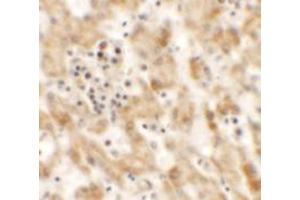 Immunohistochemistry of NKX2-8 in human liver tissue with NKX2-8 antibody at 2. (NKX2-8 抗体  (Middle Region))