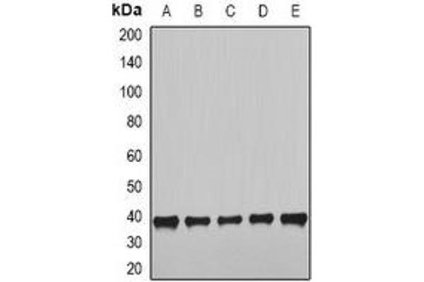NudE Neurodevelopment Protein 1 (NDE1) 抗体
