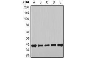 Western blot analysis of NUDE expression in HepG2 (A), SKOV3 (B), MCF7 (C), mouse heart (D), mouse lung (E) whole cell lysates. (NudE Neurodevelopment Protein 1 (NDE1) 抗体)