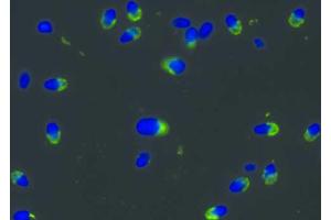 Immunocytochemistry (ICC) image for anti-Protein Kinase, CAMP-Dependent, Regulatory, Type II, alpha (PRKAR2A) antibody (ABIN1302261)