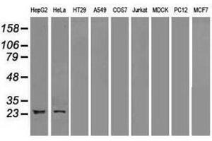 Image no. 1 for anti-Neurogenin 1 (NEUROG1) antibody (ABIN1499697) (Neurogenin 1 抗体)
