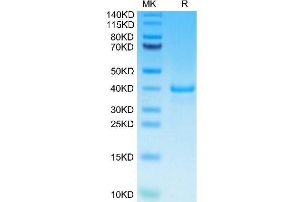 EGF Protein (AA 971-1023) (Fc Tag)