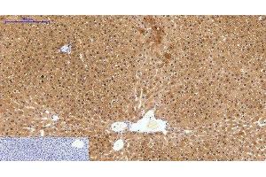 Immunohistochemistry of paraffin-embedded Human liver tissue using HAO1 Monoclonal Antibody at dilution of 1:200. (HAO1 抗体)