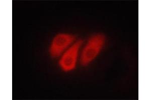 ABIN6267321 staining PC-12 cells treated with TPA by ICC/IF. (ATP1A1 抗体  (pSer23))