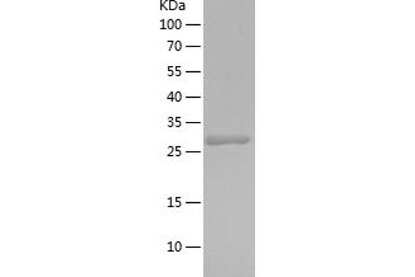 NEIL1 Protein (AA 200-390) (His tag)