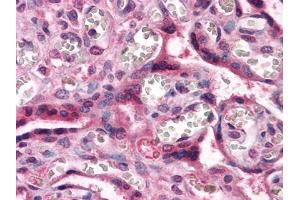 Immunohistochemical analysis of paraffin-embedded human Placenta tissues using CTNNB1 mouse mAb (CTNNB1 抗体)