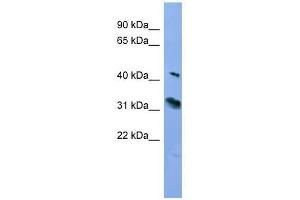 RHO antibody used at 0. (Rho-related GTP-binding protein 抗体  (C-Term))