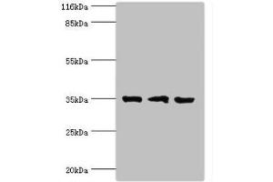Western blot All lanes: Rab effector Noc2 antibody at 2 μg/mL Lane 1: Rat liver tissue Lane 2: K562 whole cell lysate Lane 3: A549 whole cell lysate Secondary Goat polyclonal to rabbit IgG at 1/10000 dilution Predicted band size: 35, 32 kDa Observed band size: 35 kDa (RPH3AL 抗体  (AA 1-315))