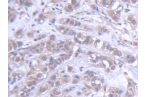 Immunohistochemistry (IHC) image for anti-ATP-Binding Cassette, Sub-Family B (MDR/TAP), Member 6 (ABCB6) (AA 590-842) antibody (ABIN5013184)