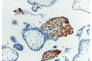 Immunohistochemistry staining with anti-human HLA-G (MEM-G/1). (HLAG 抗体  (Biotin))