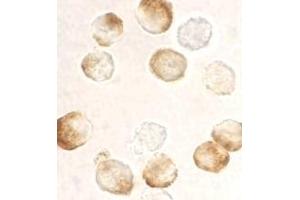 Immunocytochemistry staining of HeLa cells using AP30406PU-N IKK beta antibody at 10 μg/ml. (IKBKB 抗体  (C-Term))