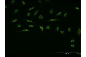 Immunofluorescence (IF) image for anti-Zic Family Member 4 (ZIC4) (AA 1-90) antibody (ABIN529574)
