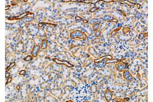 ABIN6261245 and ABIN6273225 at 1/100 staining Mouse kidney tissue by IHC-P.