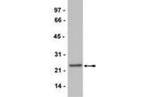 Western Blotting (WB) image for anti-CD3 (CD3) (Activation Site) antibody (ABIN400888) (CD3 抗体  (Activation Site))