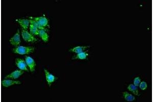 Immunofluorescent analysis of HepG2 cells using ABIN7159916 at dilution of 1:100 and Alexa Fluor 488-congugated AffiniPure Goat Anti-Rabbit IgG(H+L) (TOMM2 (AA 20-145) 抗体)