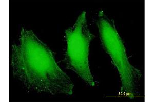 Immunofluorescence of purified MaxPab antibody to FANCA on HeLa cell. (FANCA 抗体  (AA 1-297))