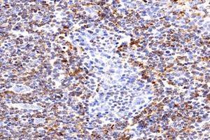 Immunohistochemistry analysis of paraffin-embedded human tonsil using,HLA-DP (ABIN7074613) at dilution of 1: 2400 (HLA-DP 抗体)