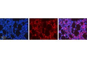 Rabbit Anti-ADRBK1 Antibody Catalog Number: ARP51965_P050 Formalin Fixed Paraffin Embedded Tissue: Human Bone Marrow Tissue Observed Staining: Cytoplasm, Plasma membrane Primary Antibody Concentration: 1:600 Other Working Concentrations: N/A Secondary Antibody: Donkey anti-Rabbit-Cy3 Secondary Antibody Concentration: 1:200 Magnification: 20X Exposure Time: 0. (GRK2 抗体  (N-Term))