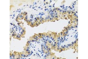 Immunohistochemistry of paraffin-embedded Mouse lung using UVRAG Polyclonal Antibody at dilution of 1:100 (40x lens). (UVRAG 抗体)