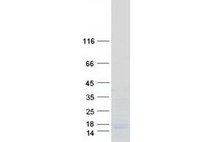 Western Blotting (WB) image for SFRS12-Interacting Protein 1 (SFRS12IP1) protein (Myc-DYKDDDDK Tag) (ABIN2731910)