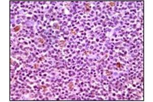 Immunohistochemistry (IHC) image for anti-Induced Myeloid Leukemia Cell Differentiation Protein Mcl-1 (MCL1) antibody (ABIN1108171) (MCL-1 抗体)