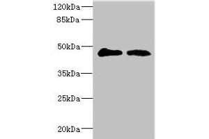Western blot All lanes: GCNT2 antibody at 3. (GCNT2 抗体  (AA 203-402))