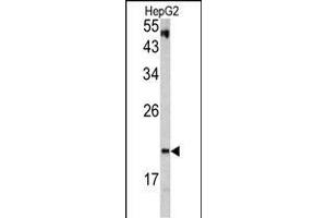Western blot analysis of VHL antibody (C-term) (ABIN390463 and ABIN2840833) in HepG2 cell line lysates (35 μg/lane). (VHL 抗体  (C-Term))