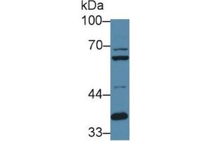 Rabbit Capture antibody from the kit in WB with Positive Control: Sample Human hela cell lysate. (FURIN ELISA 试剂盒)
